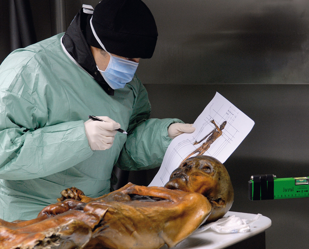 Ötzi is examined