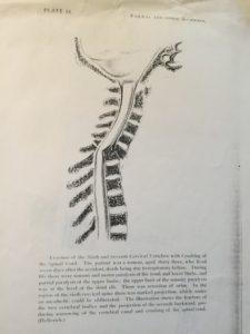 An early medical chart for courtroom use.